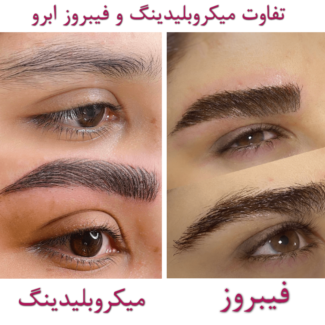 تفاوت میکروبلیدینگ با فیبروز ابرو